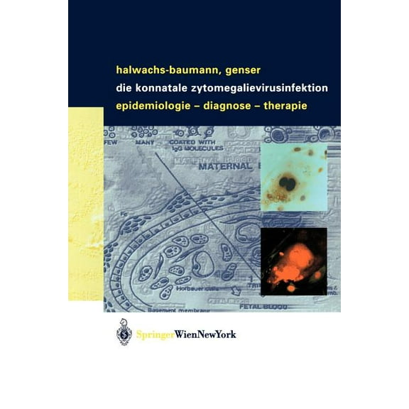 Die Konnatale Zytomegalievirusinfektion: Epidemiologie - Diagnose - Therapie, (Paperback)