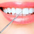 thumbnail image 2 of Ensemble de 12 Pcs de Cure-Dents en Acier Inoxydable Réutilisables, Support pour Pique-Nique en Plein Air Camping Voyage (3), 2 of 7