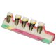 thumbnail image 2 of Modelo de dientes dentales, estructura clara de cerámica, cuidado bucal, modelo educativo de enfermedad periodontal, 2 of 8