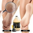 thumbnail image 7 of FOOT SPA Healing Therapy Massage Lotion, Peppermint & Eucalyptus, 128 oz - Body, Hand, Feet, 7 of 7