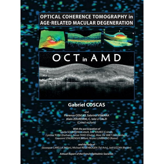 OCT in AMD Optical Coherence Tomography in Age-Related Macular Degeneration, (Paperback)