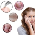 thumbnail image 2 of 2Pcs/Set Toe Nail Correction Nippers Cutters Dead Skin Dirt,Silver Nail Gel, 2 of 8