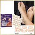 thumbnail image 1 of Pegatinas para tratamiento de uñas encarnadas Parche de corrección de uñas de los pies Herramienta de cuidado de uñas unisex, 1 of 9