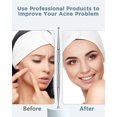 thumbnail image 4 of Blackhead Remover Tool, Pimple Popper Tool Kit, Blackhead Extractor tool for Face, Extractor Tool for Comedone Zit Acne Whitehead Blemish, Stainless S, 4 of 5