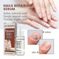 thumbnail image 3 of Jaysuing 7 Days Nail Repair Serum Nail Growth Strengthening Serum |, 3 of 3