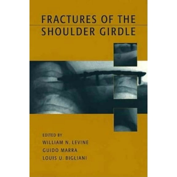 Fractures of the Shoulder Girdle, (Hardcover)