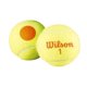 thumbnail image 1 of WILSON Sporting Goods Starter Pelota de tenis naranja - Paquete de 48 WRT13730B, 1 of 1