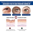 thumbnail image 4 of 100ml Collagen Anti Dark Circles Eye Cream, Anti-dark Circles Eye Cream Remove Eye Bag, 4 of 5