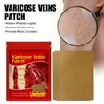 thumbnail image 1 of Parche de hierbas chinas para las venas varicosas para mejorar la salud capilar L yeso eficaz para las venas varicosas (Buy 2 get 1 free), 1 of 9