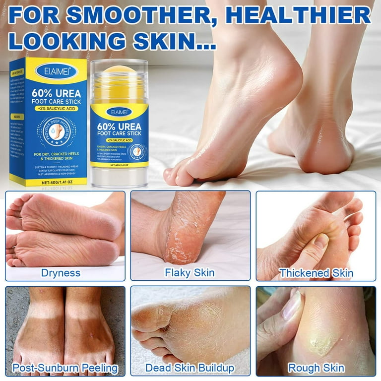 Cracked Heel Repair Restoring Balm OZ, with 60% Urea