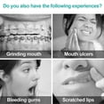 thumbnail image 3 of Braces Wax Dental Wax with Storage Cases, 10 Orthodontic Wax Strips for Braces Aligners Wearer--, 3 of 5