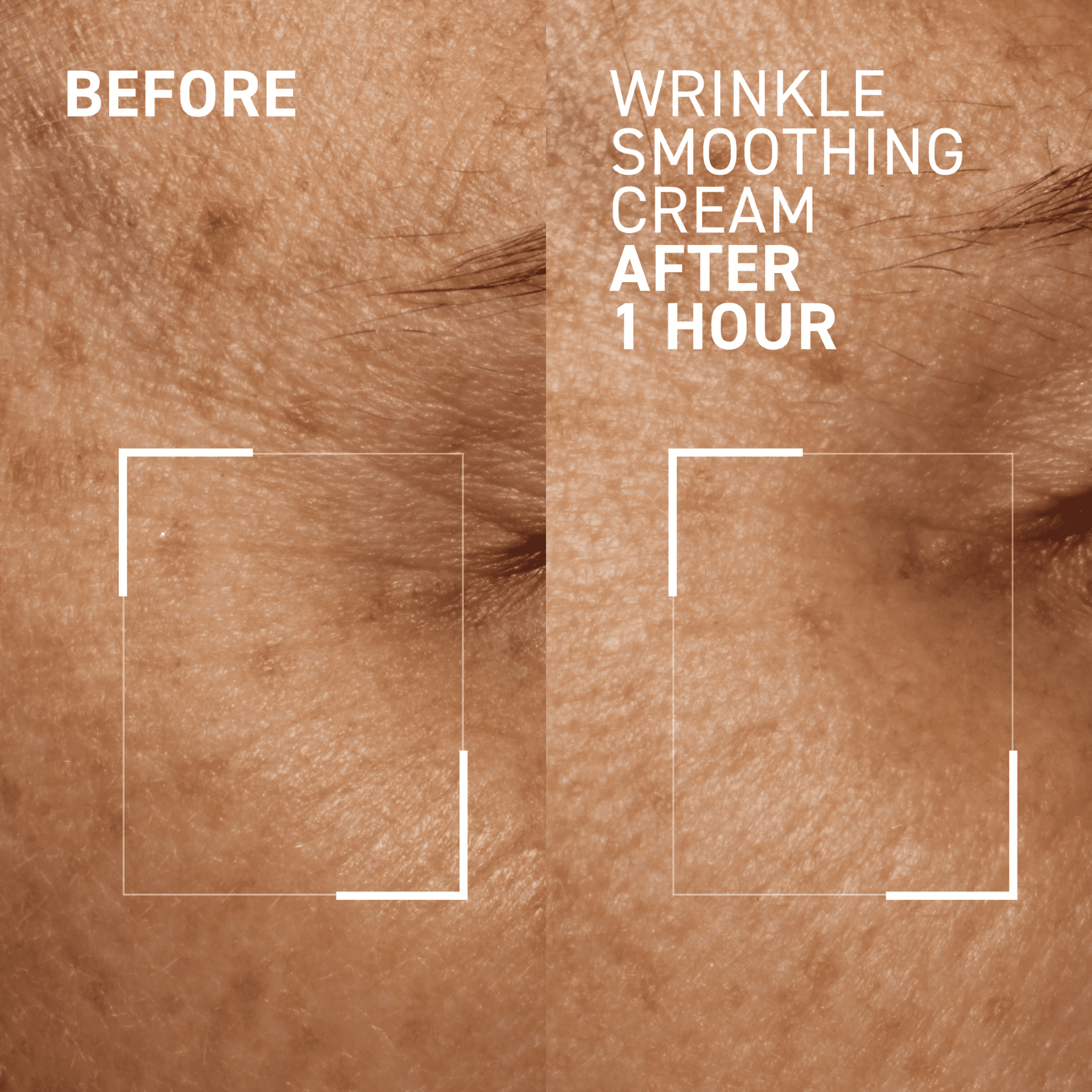 Dr. Brandt Skincare Needles No More® Wrinkle Smoothing Cream