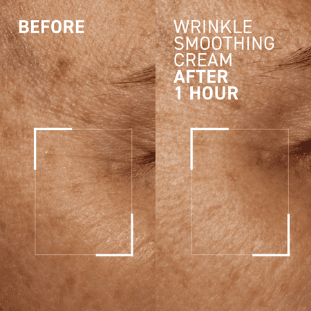 Dr. Brandt Skincare Needles No More® Wrinkle Smoothing Cream