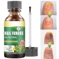 thumbnail image 1 of 30ml Toenail Fungus Treatment, Tea Tree Oil For Toenail Fungus, Antifungal Nail Solution Care Essence, 1 of 5