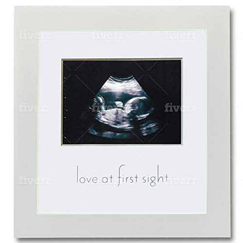 Sonogram Picture Frame White Wooden Baby Ultrasound Photo Frame, Cute