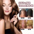 thumbnail image 2 of Onion Hair Growth Spray with Healthy Herbal Formula Spray for Stronger Thicker Longer Hair, 2 of 5