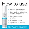 thumbnail image 2 of Limpiador facial ClN Limpiador de acné con 0,5% de ácido salicílico, 2 of 8