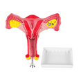 thumbnail image 2 of 1:1 Human Female Uterus Ovary Fallopian Tubes Model Anatomical Anatomy Teaching Tools, 2 of 4