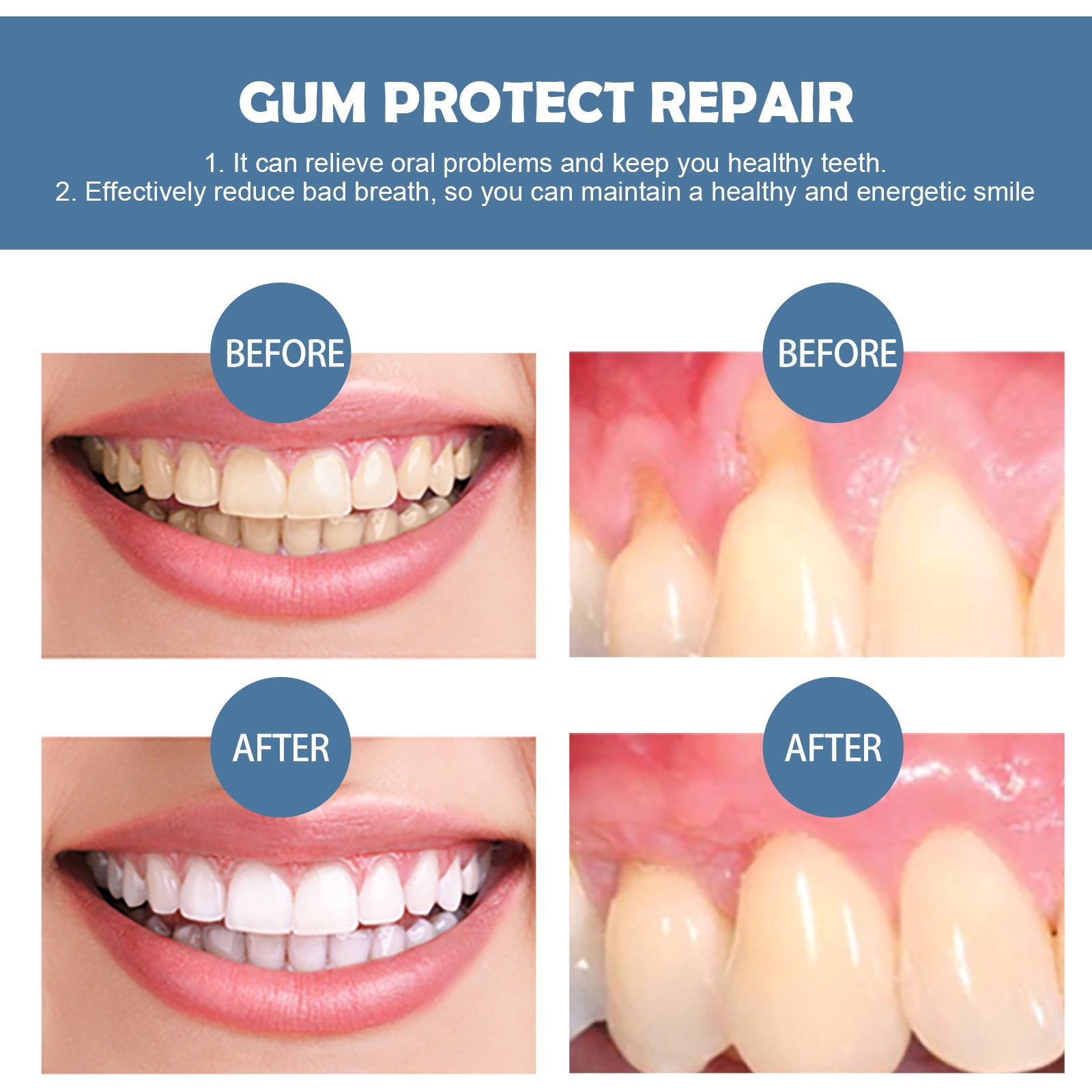 Wax for Teeth Rest ning Emulsion Luminous Teeth ning Real Braces for Teeth Plaque Checker Remover Nozzles for Teeth Brushes Toothbrush And Water Pick Combo Plaque Removal