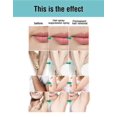 thumbnail image 3 of 3x Powerful Permanent Painless Hair Removal Spray Stop Hair Growth Inhibitor, 3 of 5