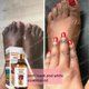 thumbnail image 2 of Esencia blanqueadora para nudillos, suero corporal para manchas oscuras, partes íntimas, elimina la melanina íntima, para el cuidado de la piel, 2 of 5