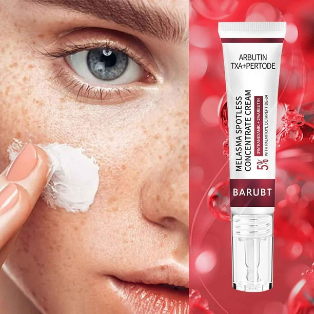 Puntoco Crema concentrada Arbutins Melasma Spotless - Crema blanqueadora Crema para eliminar manchas Crema para atenuar pecas Atenuar las manchas Cloasma Pecas Iluminador