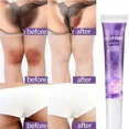 thumbnail image 5 of Crema blanqueadora de piel, blanqueador de partes privadas, iluminador de piel oscura, brazo, muslo, cuerpo, rodillas, ilumina la piel suave, 5 of 5