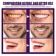 thumbnail image 4 of Enjuague bucal concentrado para el mal aliento, manchas, dientes amarillos, limpieza bucal fresca y dientes, enjuague bucal, pasta de dientes, 4 of 5