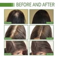 thumbnail image 5 of Aceite Shelure, aceite para el cabello Shelure, aceite para el tratamiento del crecimiento del cabello Shelure, 5 of 5