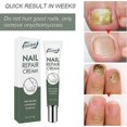 thumbnail image 4 of 2026 Nail Care Nail Repair Cream Nail Fungus Treatment Onychomycosis Nail Carenail Repair Cream Nail Moisturizing Restore Beautiful Nails Fungi Nail F, 4 of 5