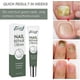 thumbnail image 4 of 2026 Nail Care Nail Repair Cream Nail Fungus Treatment Onychomycosis Nail Carenail Repair Cream Nail Moisturizing Restore Beautiful Nails Fungi Nail F, 4 of 5