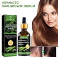 thumbnail image 5 of Suero avanzado para el crecimiento del cabello. Promueve, hidrata, fortalece el cabello y nutre el cuero cabelludo. Para hombres y mujeres. 30 ml de aceites esenciales., 5 of 5
