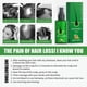 thumbnail image 4 of 30ml Ginger Hair Growth Spray Serum Anti Pérdida de cabello Reparación de la calvicie Cuidado del cabello Likrtyny Cuidado Belleza, 4 of 5