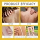 thumbnail image 5 of Clearance Sale! Bee Vēnom Soap Of Derma Care Soap Moisturizing & Cleaning Helping To Clear Accumulated Soap Men And Women Of All Ages (Buy 2 get 1 free), 5 of 9