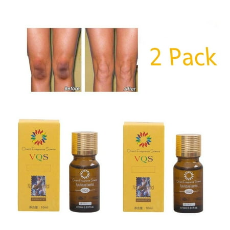 Age Spot Removal - 2 PACK Ultra Brightening Spotless Oil Dark Spots Removal Age Spots Hyper - Pigmentation(10ml)