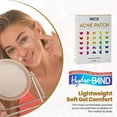 thumbnail image 2 of MEDca Acne Care Pimple Patch Absorbing Covers - 16 Count Cheek Size Acne Spot Hydrocolloid Bandage, 2 of 9
