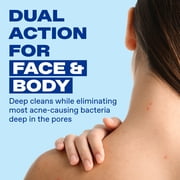 Differin Maximum Strength Acne Foaming Cleanser Face and Body Wash with 10% Benzoyl Peroxide, Fast-Acting Acne Treatment, 5 oz