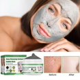 thumbnail image 4 of Mascarillas faciales hidratantes con espuma de oxígeno y carbonato para el cuidado de la piel de marca Bubble Mask para limpieza y aplicación, 4 of 5