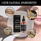 thumbnail image 4 of 1-3pcs Allurium Hair Growth Serum for Black Women, 2023 New Allurium Hair Growth Serum, 4 of 5