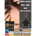 thumbnail image 2 of Loción de masaje para el cabello para hombres y mujeres, 2024 potente, 2 of 5