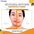 thumbnail image 4 of Crema correctora de manchas, neoprosona, 20% vitamina C, 30 ml, 4 of 7