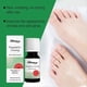 thumbnail image 3 of SOUTH MOON Nail Fungus Solution 10ml Toenail Fungus Treatment for Fragile, Discolored & Damaged, 3 of 5