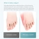 thumbnail image 3 of Corrector de Juanetes Hueso Pulgar Ajustador Likrtyny Cuidado de los Pies, 3 of 9