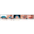 thumbnail image 3 of 2pcs Children Dental Tooth Orthodontic Appliance Trainer Kids Alignment Braces, 3 of 5