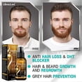 thumbnail image 2 of Biotin Hair Growth Spray Serum Anti Hair Loss Treatment Hair Regrowth for Women Men, 2 of 5