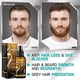 thumbnail image 2 of Biotin Hair Growth Spray Serum Anti Hair Loss Treatment Hair Regrowth for Women Men, 2 of 5