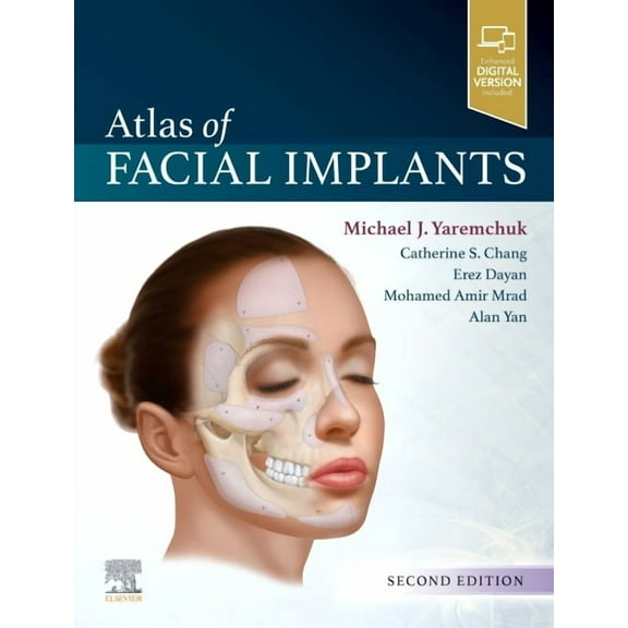 Atlas of Facial Implants, (Hardcover)