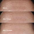 thumbnail image 4 of Suero Clinique Smart Clinical Repair Corrector de Arrugas 50 ml, 4 of 7