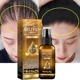 thumbnail image 2 of Productos de Spray para el crecimiento rápido del cabello, suero Anti pérdida de cabello, previene la calvicie, tratamiento del cuero cabelludo, aceite esencial seco y dañado, belleza del cabello, 30m, 2 of 5