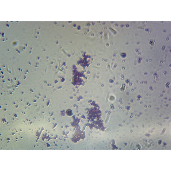 Haemophilus (Gram-Negative) and Streptoccus pneumoniae (Gram-Positive); Smear by Go Science Crazy